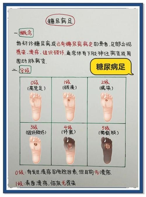 如何預防爛身病，權威醫學指南中關于“爛身病”的預防措施（如cdc、mayoclinic）