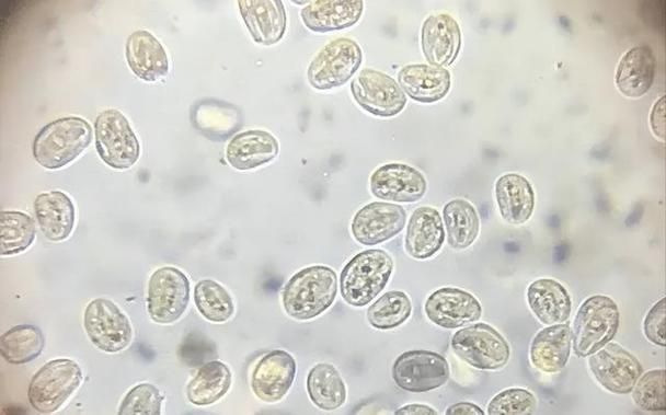 如何區分龍魚的肉疙瘩是病還是正常？，如何區分龍魚的“肉疙瘩”是病還是正常