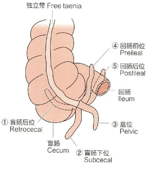 爛尾病有哪些治療方法
