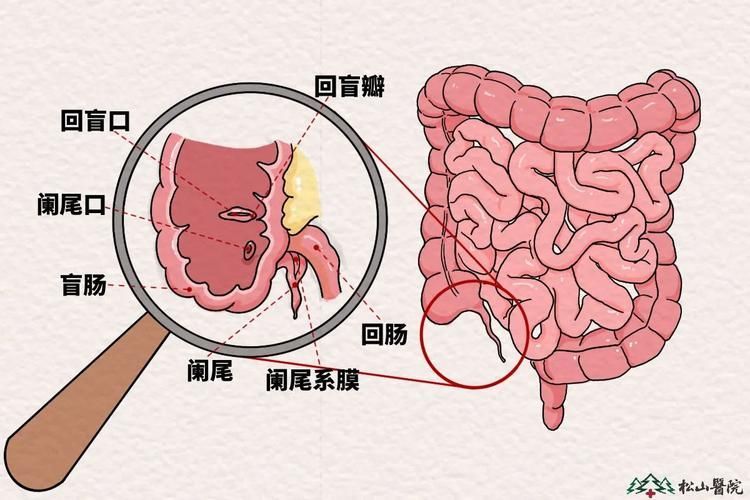 爛尾病有哪些治療方法