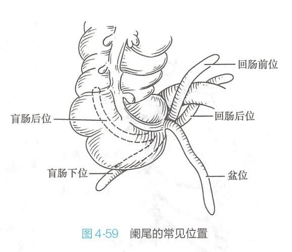 爛尾病有哪些治療方法