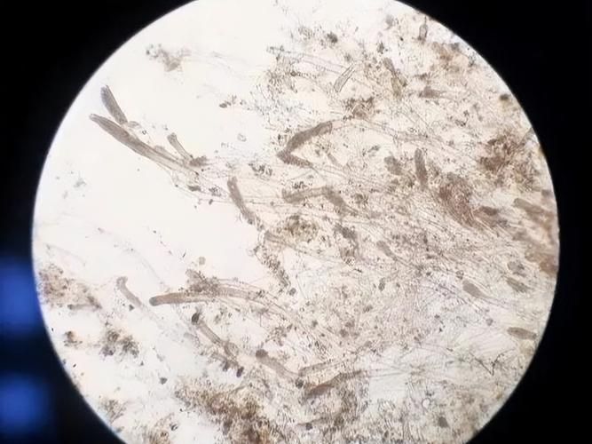 有哪些常見的觀賞魚疾病，關(guān)于觀賞魚常見疾病的一些建議