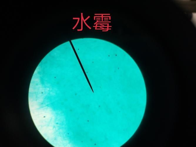 水霉病預防措施有哪些