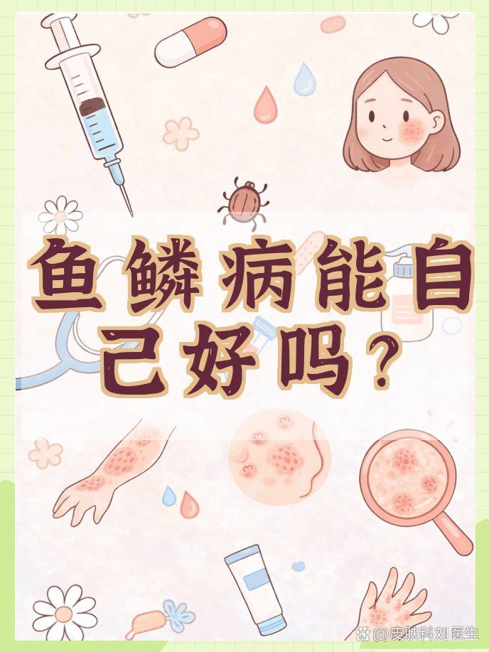 魚鱗病會自愈嗎，魚鱗病會自愈嗎，