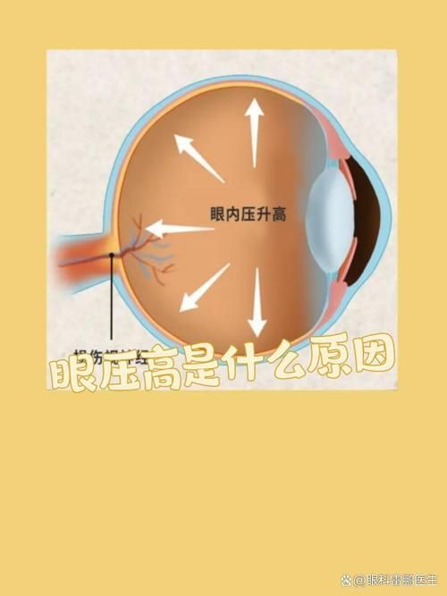 如何判斷氣蒙眼的原因，如何判斷氣蒙眼