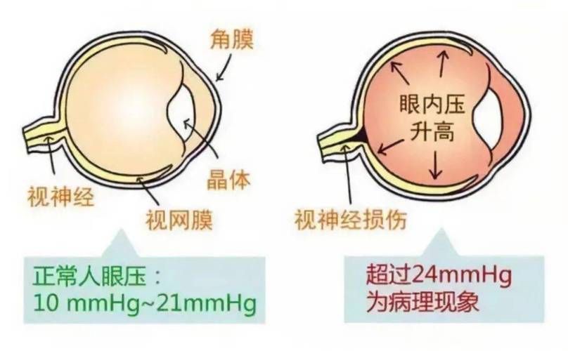 如何判斷氣蒙眼的原因，如何判斷氣蒙眼