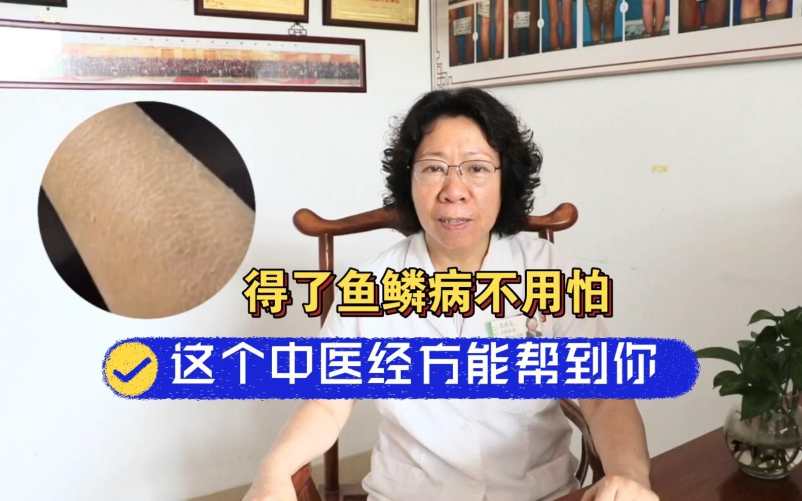 有哪些方法可以去除小腿魚鱗紋，如何去除小腿魚鱗紋
