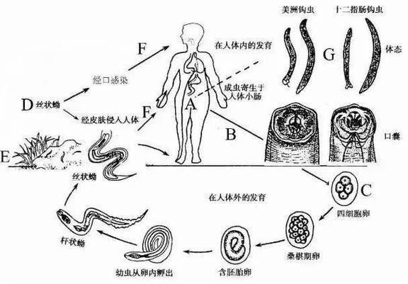 如何預防寄生蟲感染