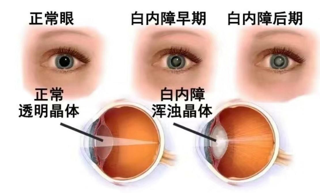龍貓先天性疾病有哪些常見類型，龍貓先天性疾病、胸腔積液、脾臟栓塞類型思考完成