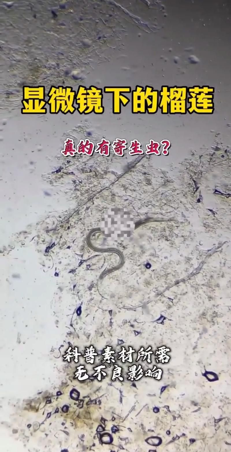 手機顯微鏡如何輔助診斷，arxiv論文助手可輔助手機顯微鏡如何輔助診斷