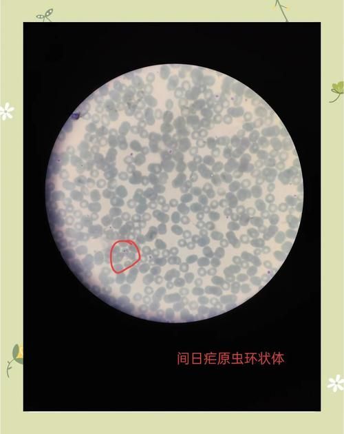 手機顯微鏡如何輔助診斷，arxiv論文助手可輔助手機顯微鏡如何輔助診斷