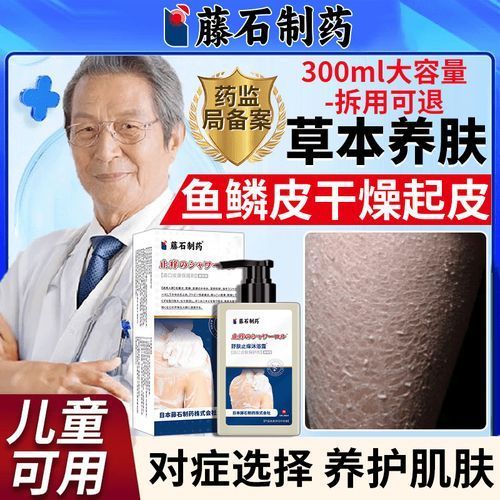 有哪些適合魚鱗病人的沐浴露推薦，適合魚鱗病人的沐浴露
