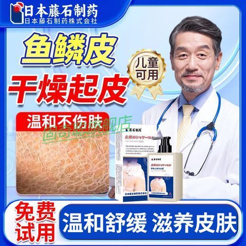 有哪些適合魚鱗病人的沐浴露推薦，適合魚鱗病人的沐浴露