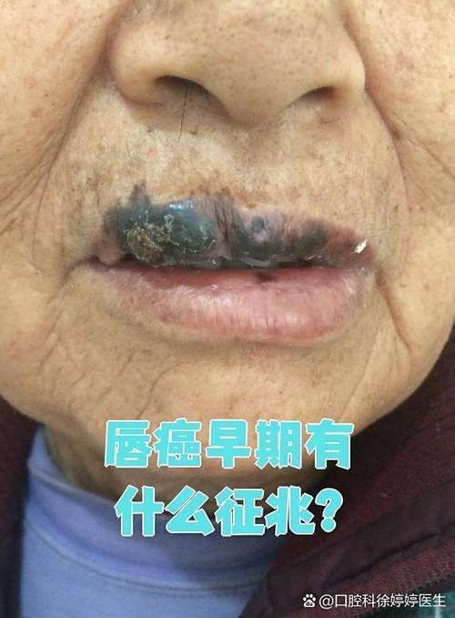 如何判斷龍魚嘴上長的是不是癌？，如何判斷龍魚嘴上長癌
