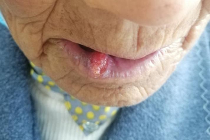 如何判斷龍魚嘴上長的是不是癌？，如何判斷龍魚嘴上長癌