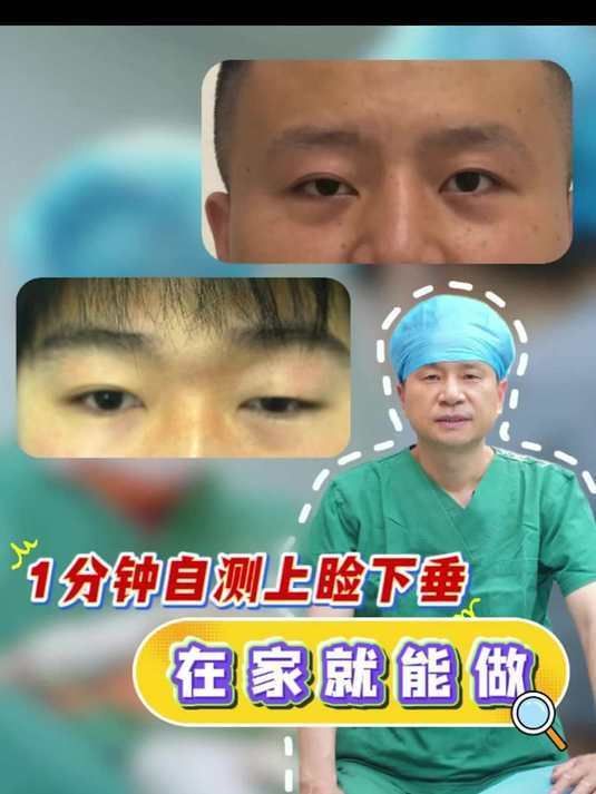 如何判斷自己是否掉眼，如何判斷上瞼下垂
