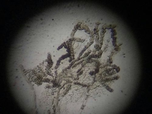 如何判斷魚鰓是否爛了，如何判斷魚鰓是否爛了———科學診斷指南