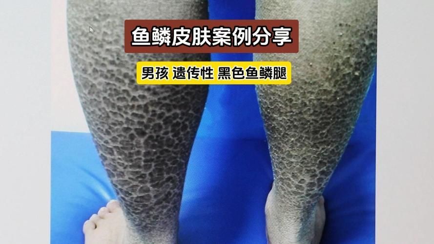 如何判斷黑鱗龍魚是否健康，如何判斷黑鱗龍魚是否健康有力、姿態(tài)優(yōu)雅、主動探索