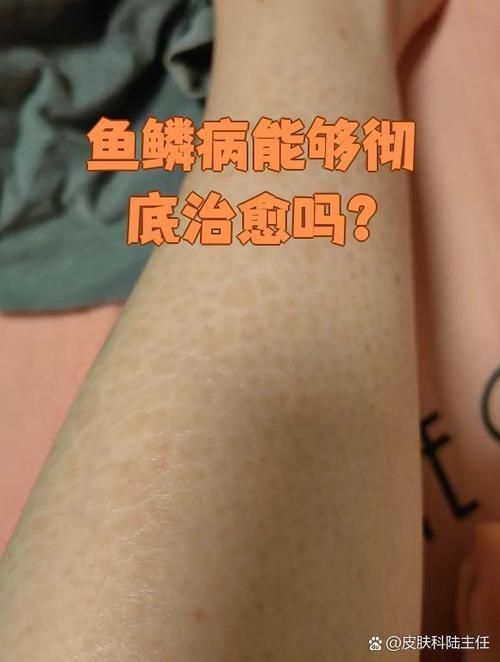 魚立鱗病最嚴(yán)重圖片，魚立鱗病最嚴(yán)重圖片展示