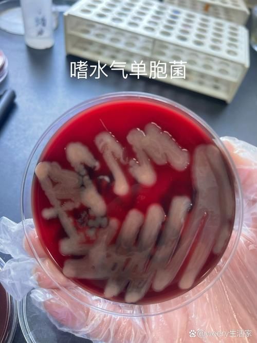 如何預(yù)防魚鰭根部發(fā)紅傳染，如何預(yù)防魚鰭嗜水氣單胞菌、柱狀黃桿菌、柱狀黃桿菌