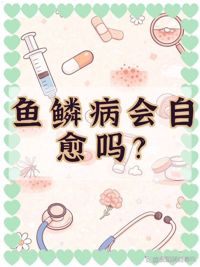 魚鱗病可以自愈嗎，魚鱗病會自愈嗎