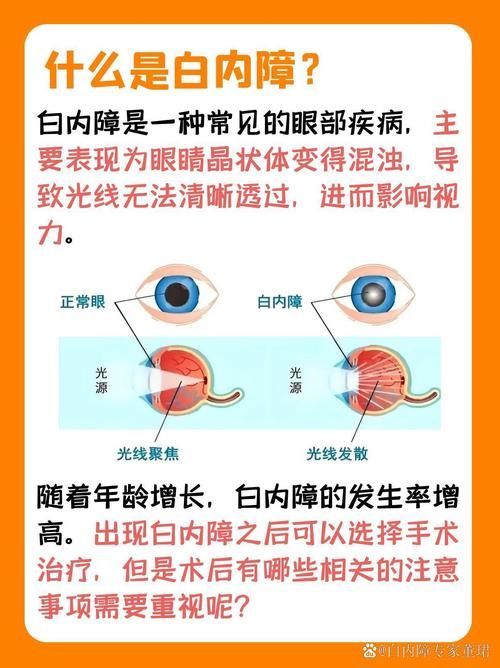 蒙眼病有哪些癥狀，“蒙眼病”有哪些癥狀用戶要求詳細解釋“蒙眼病”的癥狀
