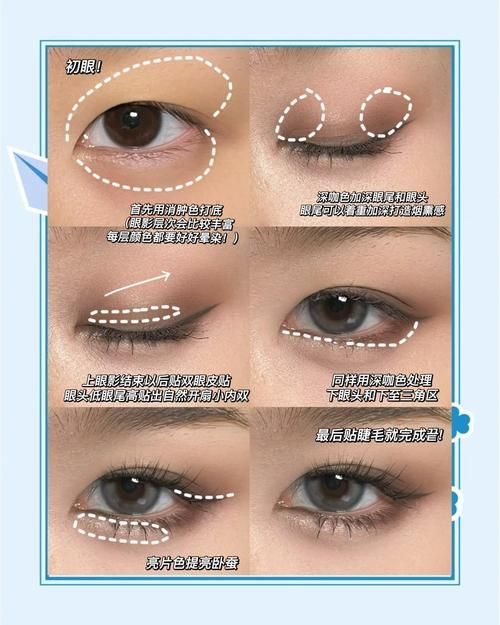 如何區(qū)分外蒙眼和內(nèi)蒙眼，“內(nèi)蒙眼”并非標(biāo)準(zhǔn)醫(yī)學(xué)術(shù)語