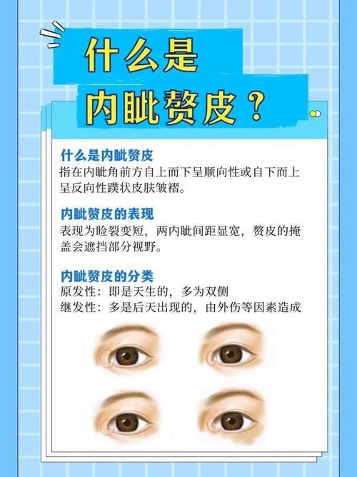 如何區(qū)分外蒙眼和內(nèi)蒙眼，“內(nèi)蒙眼”并非標(biāo)準(zhǔn)醫(yī)學(xué)術(shù)語