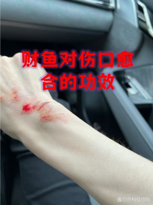 魚咬傷后多久會恢復，百度健康-去問診魚咬傷后多久會恢復思考完成