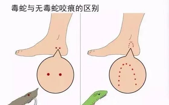 魚咬傷后多久會恢復(fù)，百度健康-去問診魚咬傷后多久會恢復(fù)思考完成