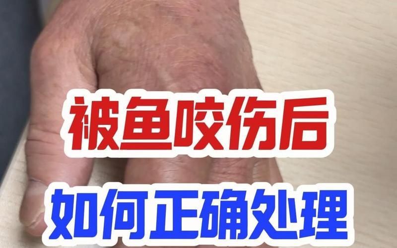 魚咬傷后多久會恢復(fù)，百度健康-去問診魚咬傷后多久會恢復(fù)思考完成
