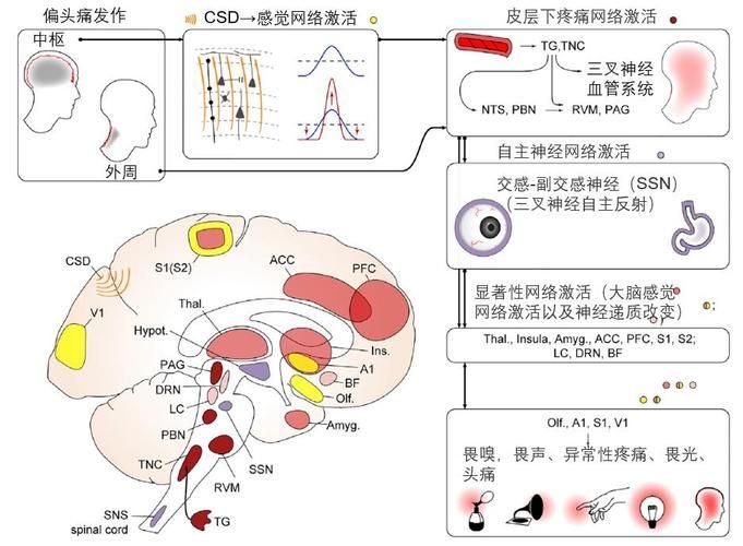 哪種治療方法最適合我，中華醫(yī)學(xué)會《中國偏頭痛診斷與治療指南》1000字詳解