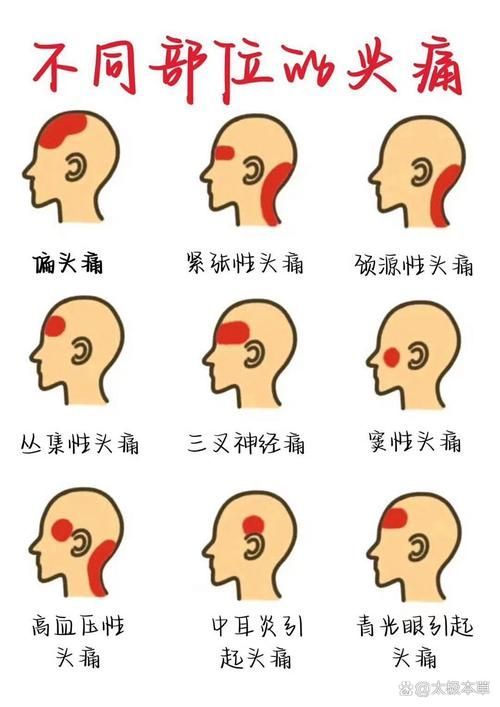 哪種治療方法最適合我，中華醫(yī)學(xué)會《中國偏頭痛診斷與治療指南》1000字詳解
