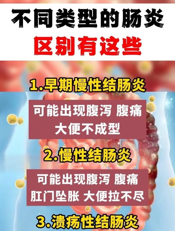如何區分不同類型的腸炎，不同類型的腸炎區分不同類型的腸炎
