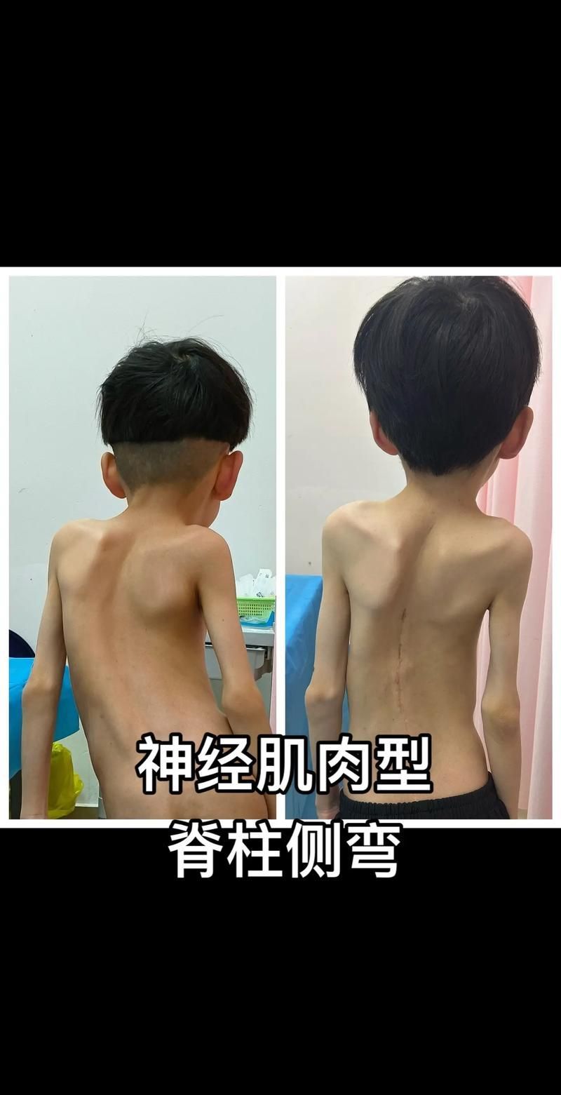 如何判斷龍魚是否缺乏維生素A或C？，如何判斷龍魚是否缺乏維生素a或c