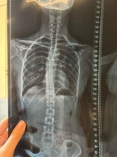 如何判斷龍魚是否缺乏維生素A或C？，如何判斷龍魚是否缺乏維生素a或c