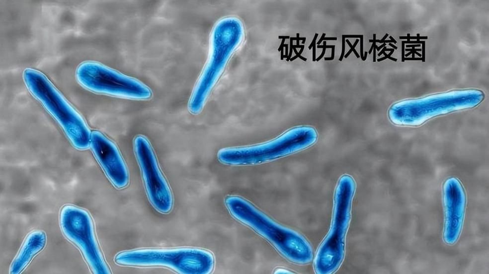 詳細介紹幾種常見的爛身病病原體，“爛身病”是一種由多種常見的爛身病原體引起的疾病