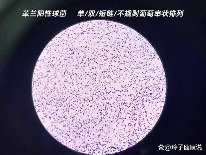 詳細介紹幾種常見的爛身病病原體，“爛身病”是一種由多種常見的爛身病原體引起的疾病