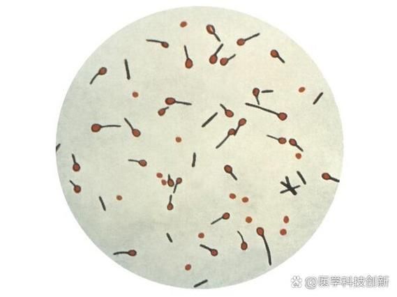 詳細介紹幾種常見的爛身病病原體，“爛身病”是一種由多種常見的爛身病原體引起的疾病