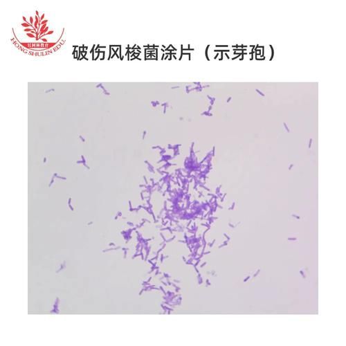 詳細介紹幾種常見的爛身病病原體，“爛身病”是一種由多種常見的爛身病原體引起的疾病