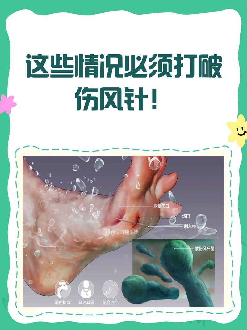 哪些情況下需要打破傷風針，**，傷風針，即破傷風抗毒素（tetanusxin）