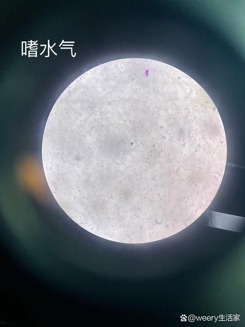 如何區分這四種病原體引起的爛身病，如何區分四種病原體引起的爛身病