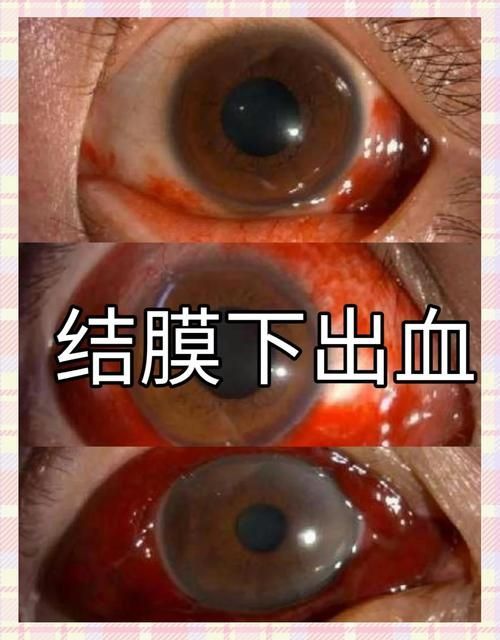 如何區(qū)分物理?yè)p傷和細(xì)菌性出血病，如何區(qū)分物理?yè)p傷與細(xì)菌性出血病