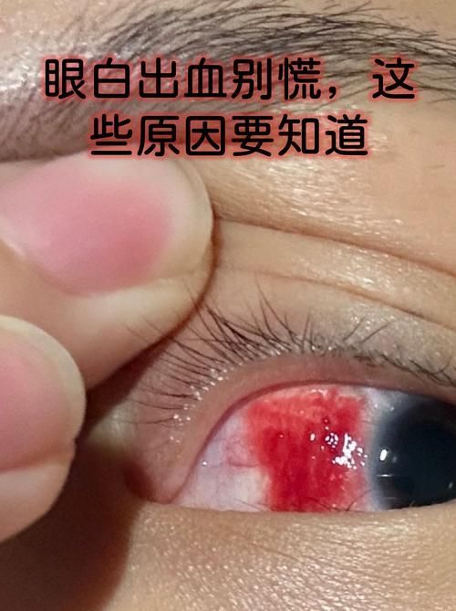 如何區(qū)分物理?yè)p傷和細(xì)菌性出血病，如何區(qū)分物理?yè)p傷與細(xì)菌性出血病