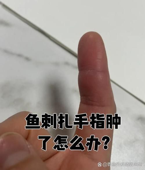 火龍魚(yú)中毒后如何急救？