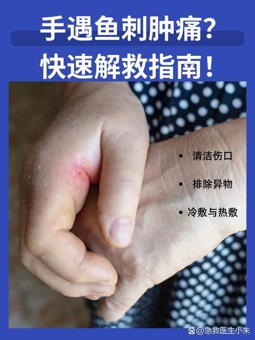 火龍魚(yú)中毒后如何急救？