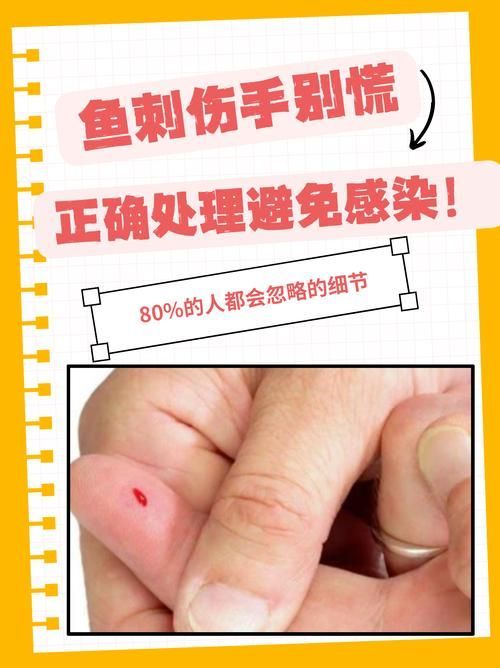 火龍魚(yú)中毒后如何急救？