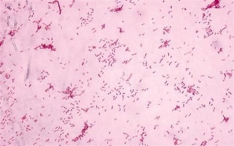 壓養龍魚會有什么健康風險？