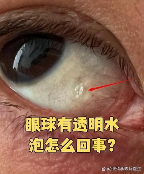如何判斷紅龍魚眼病是否好轉(zhuǎn)？，如何判斷紅龍魚眼病好轉(zhuǎn)