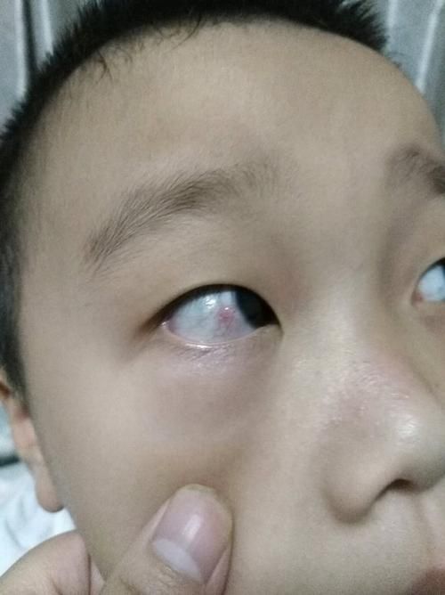 如何判斷紅龍魚眼病是否好轉？，如何判斷紅龍魚眼病好轉